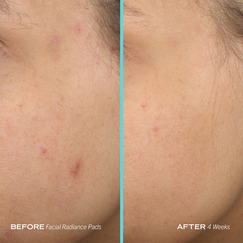 First Aid Beauty Facial Radiance Pads with Glycolic + Lactic Acids - 28 Pads